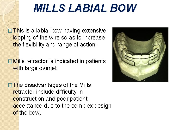 MILLS LABIAL BOW � This is a labial bow having extensive looping of the MILLS LABIAL BOW � This is a labial bow having extensive looping of the