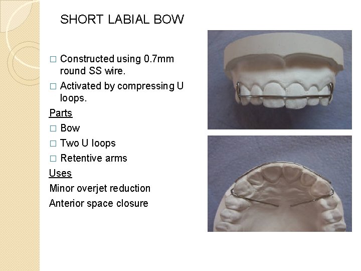 SHORT LABIAL BOW � Constructed using 0. 7 mm round SS wire. Activated by