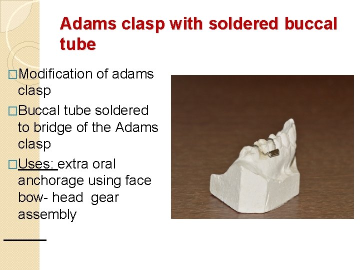 Adams clasp with soldered buccal tube �Modification of adams clasp �Buccal tube soldered to