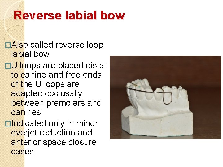Reverse labial bow �Also called reverse loop labial bow �U loops are placed distal Reverse labial bow �Also called reverse loop labial bow �U loops are placed distal