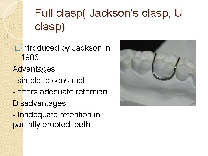 Full clasp( Jackson’s clasp, U clasp) �Introduced by Jackson in 1906 Advantages - simple Full clasp( Jackson’s clasp, U clasp) �Introduced by Jackson in 1906 Advantages - simple