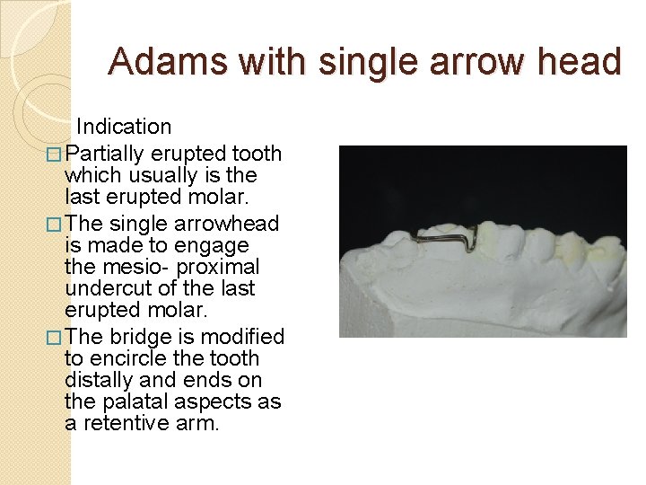 Adams with single arrow head Indication � Partially erupted tooth which usually is the