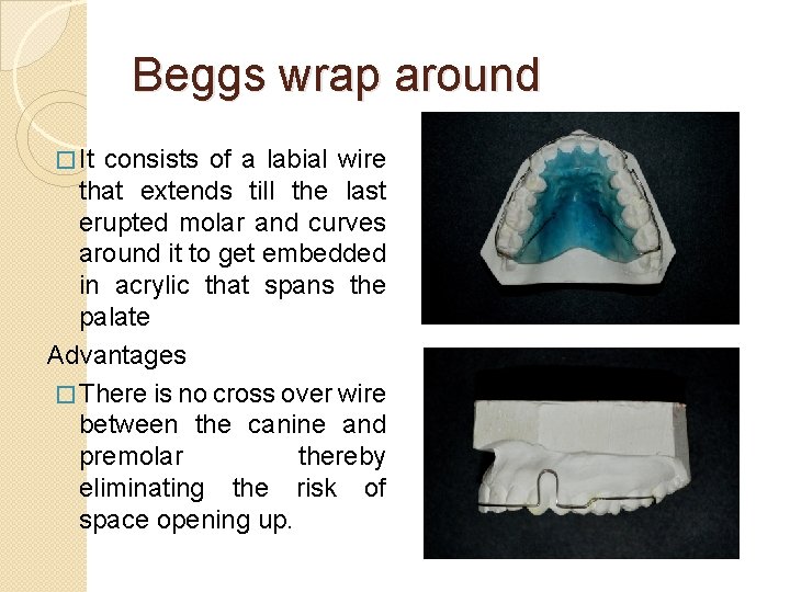 Beggs wrap around � It consists of a labial wire that extends till the Beggs wrap around � It consists of a labial wire that extends till the