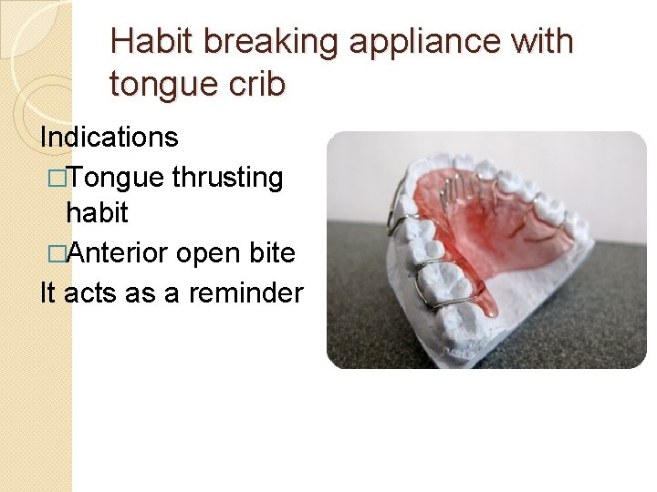 Habit breaking appliance with tongue crib Indications �Tongue thrusting habit �Anterior open bite It