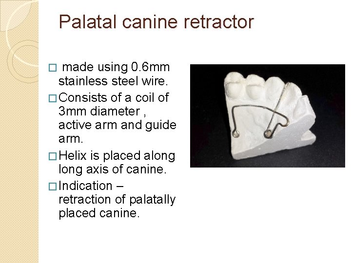 Palatal canine retractor made using 0. 6 mm stainless steel wire. � Consists of