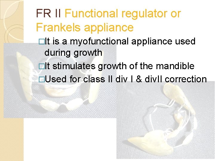 FR II Functional regulator or Frankels appliance �It is a myofunctional appliance used during FR II Functional regulator or Frankels appliance �It is a myofunctional appliance used during