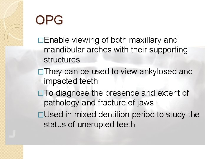 OPG �Enable viewing of both maxillary and mandibular arches with their supporting structures �They