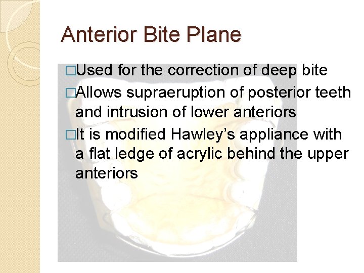 Anterior Bite Plane �Used for the correction of deep bite �Allows supraeruption of posterior Anterior Bite Plane �Used for the correction of deep bite �Allows supraeruption of posterior