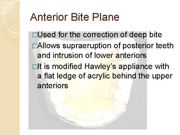 Anterior Bite Plane �Used for the correction of deep bite �Allows supraeruption of posterior