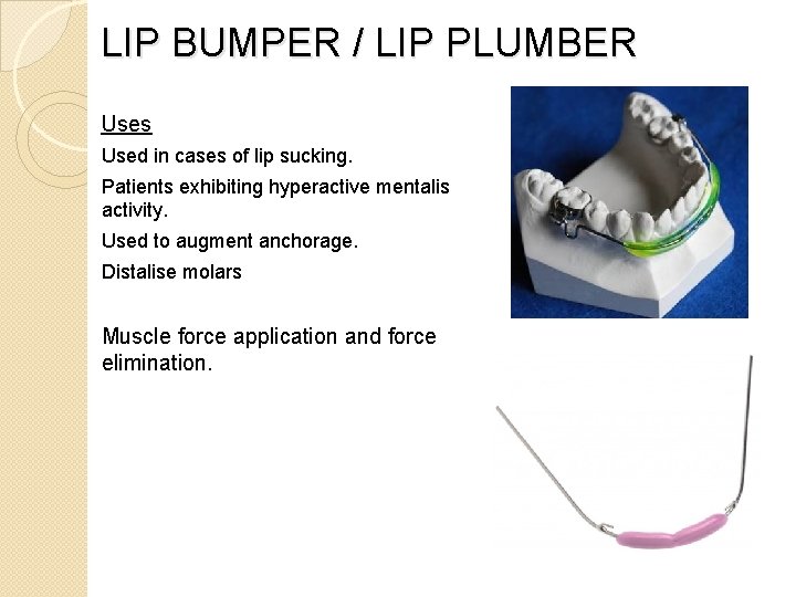 LIP BUMPER / LIP PLUMBER Uses Used in cases of lip sucking. Patients exhibiting