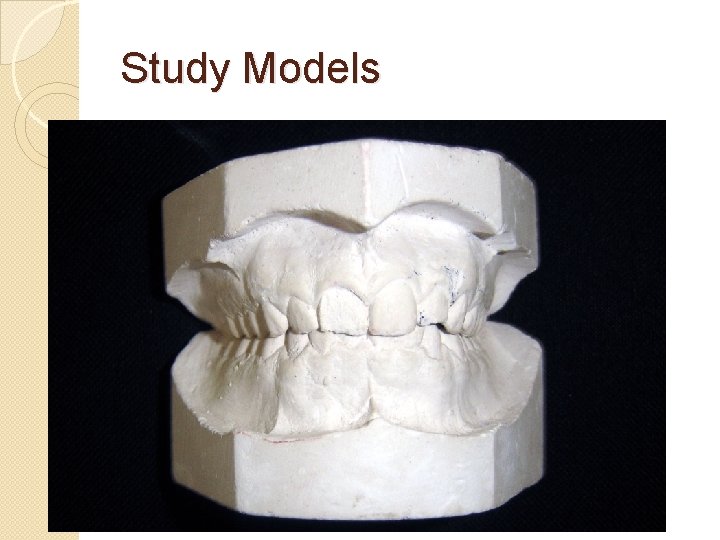 Study Models 