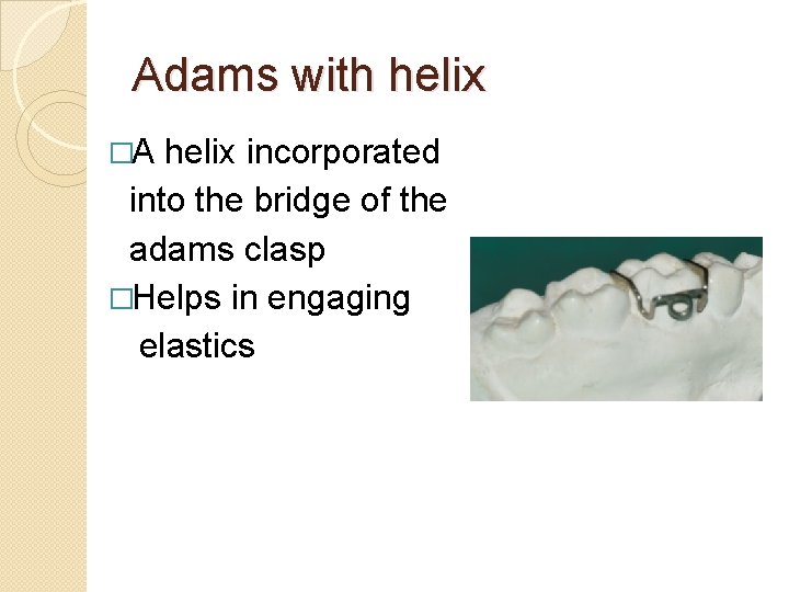 Adams with helix �A helix incorporated into the bridge of the adams clasp �Helps Adams with helix �A helix incorporated into the bridge of the adams clasp �Helps