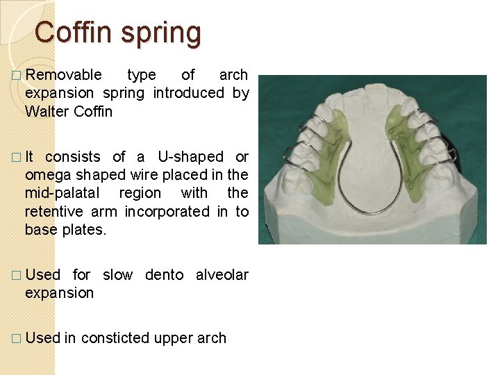 Coffin spring � Removable type of arch expansion spring introduced by Walter Coffin �