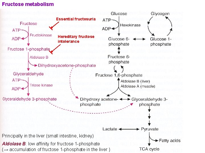 Fructose metabolism Essential fructosuria Hereditary fructose intolerance Principally in the liver (small intestine, kidney)