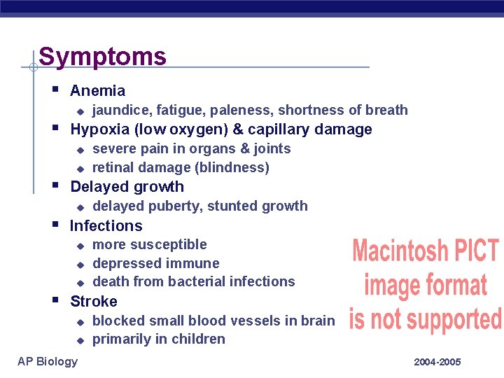 Symptoms § Anemia u jaundice, fatigue, paleness, shortness of breath § Hypoxia (low oxygen)