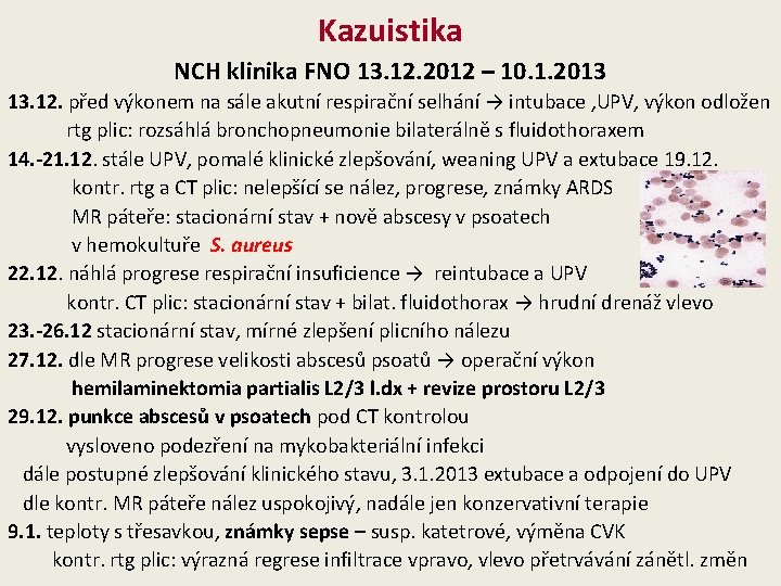 Kazuistika NCH klinika FNO 13. 12. 2012 – 10. 1. 2013 13. 12. před