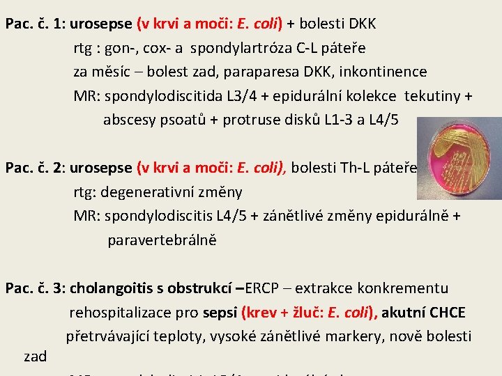 Pac. č. 1: urosepse (v krvi a moči: E. coli) + bolesti DKK rtg