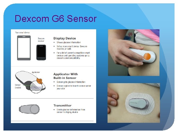 Dexcom G 6 Sensor 