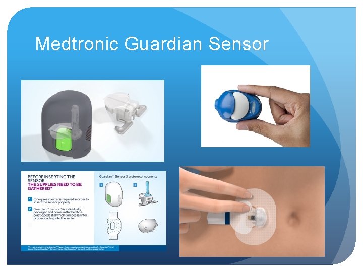 Medtronic Guardian Sensor 