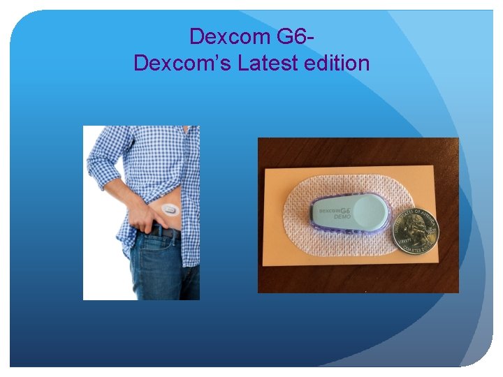 Dexcom G 6 Dexcom’s Latest edition 
