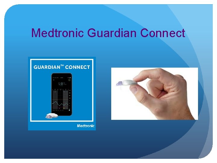 Medtronic Guardian Connect 
