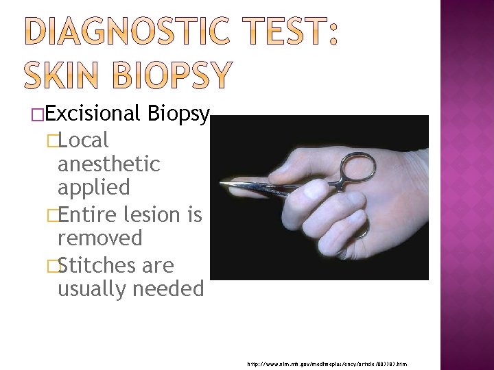 �Excisional Biopsy �Local anesthetic applied �Entire lesion is removed �Stitches are usually needed http: