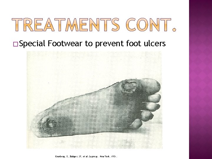 � Special Footwear to prevent foot ulcers Grunberg, E. , Babger, LF, et al.