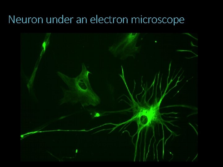 Neuron under an electron microscope 