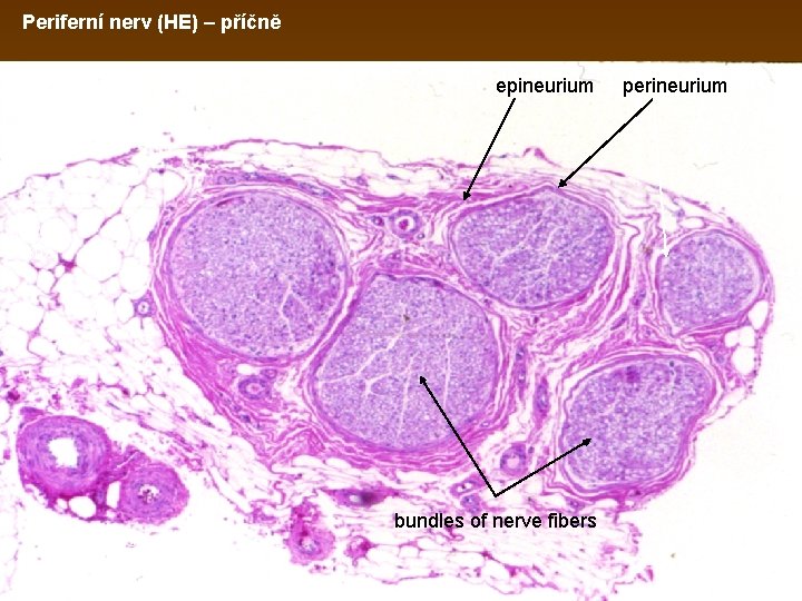Periferní nerv (HE) – příčně epineurium perineurium adipose tissue blood vessels bundles of nerve