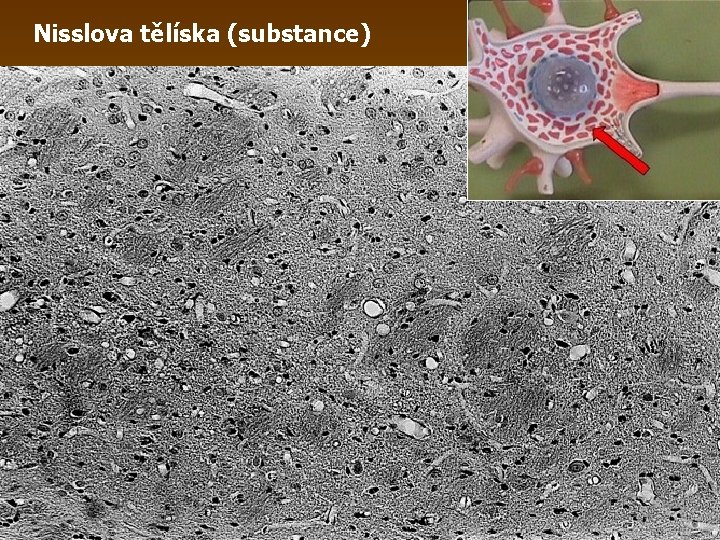 Nisslova tělíska (substance) 