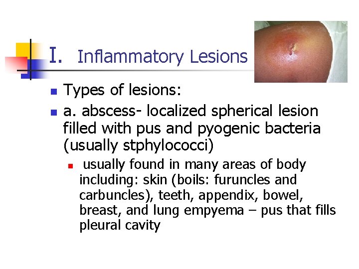 I. Inflammatory Lesions n n Types of lesions: a. abscess- localized spherical lesion filled