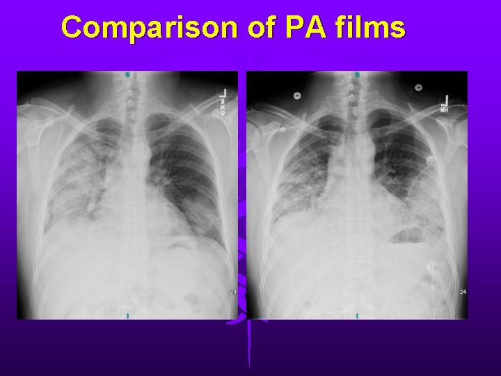 Comparison of PA films 