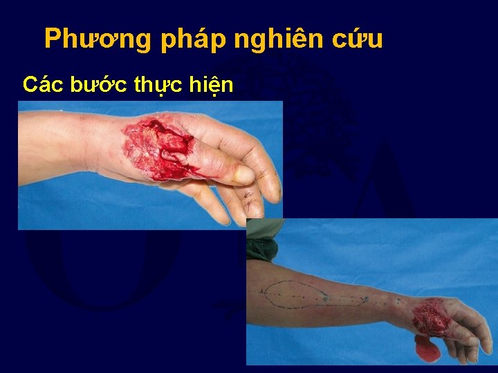 Phương pháp nghiên cứu Các bước thực hiện 