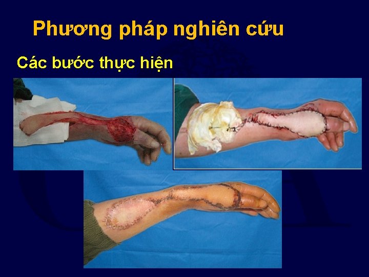 Phương pháp nghiên cứu Các bước thực hiện 