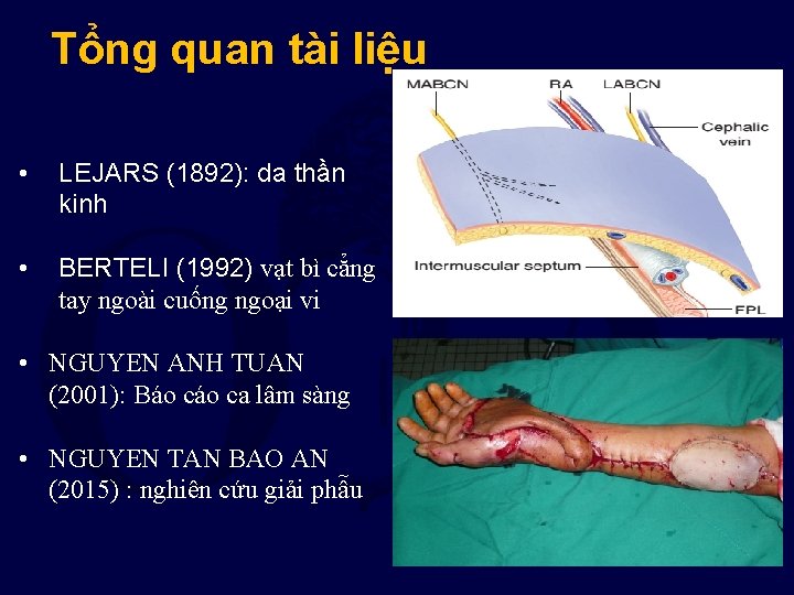 Tổng quan tài liệu • LEJARS (1892): da thần kinh • BERTELI (1992) vạt