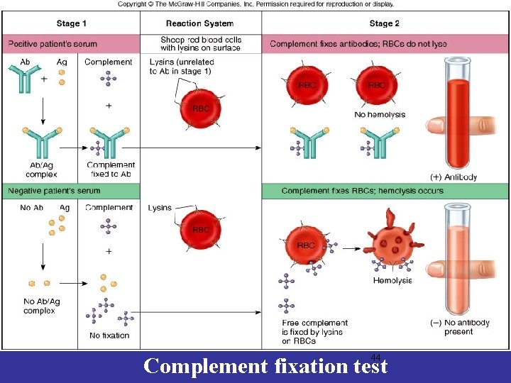 44 Complement fixation test 