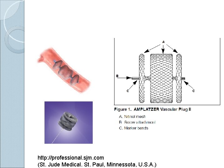 http: //professional. sjm. com (St. Jude Medical. St. Paul, Minnessota, U. S. A. )