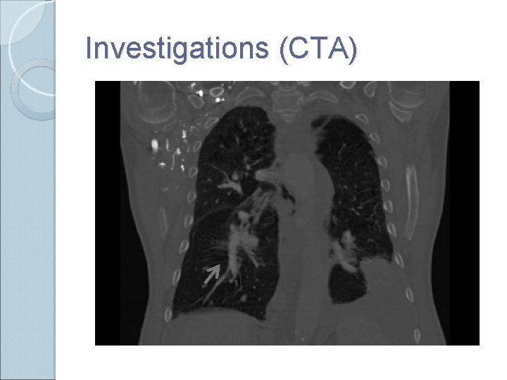 Investigations (CTA) 