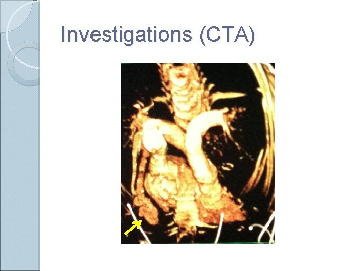 Investigations (CTA) 