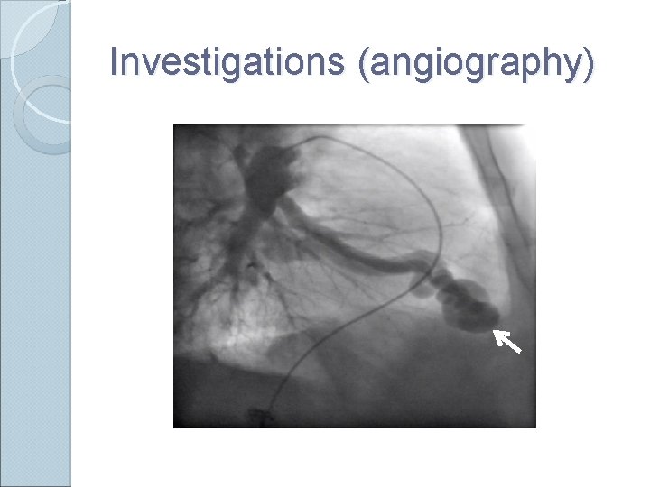 Investigations (angiography) 