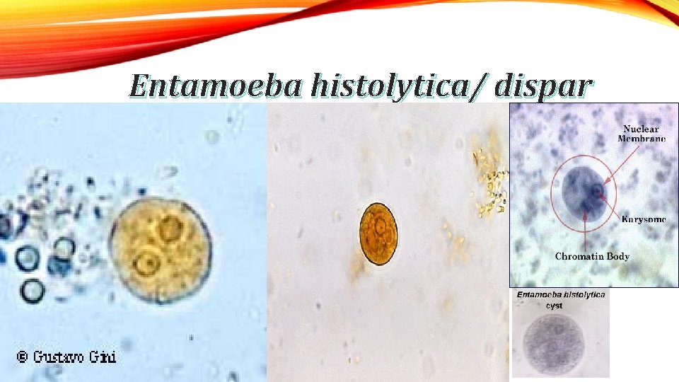 Entamoeba histolytica/ dispar 