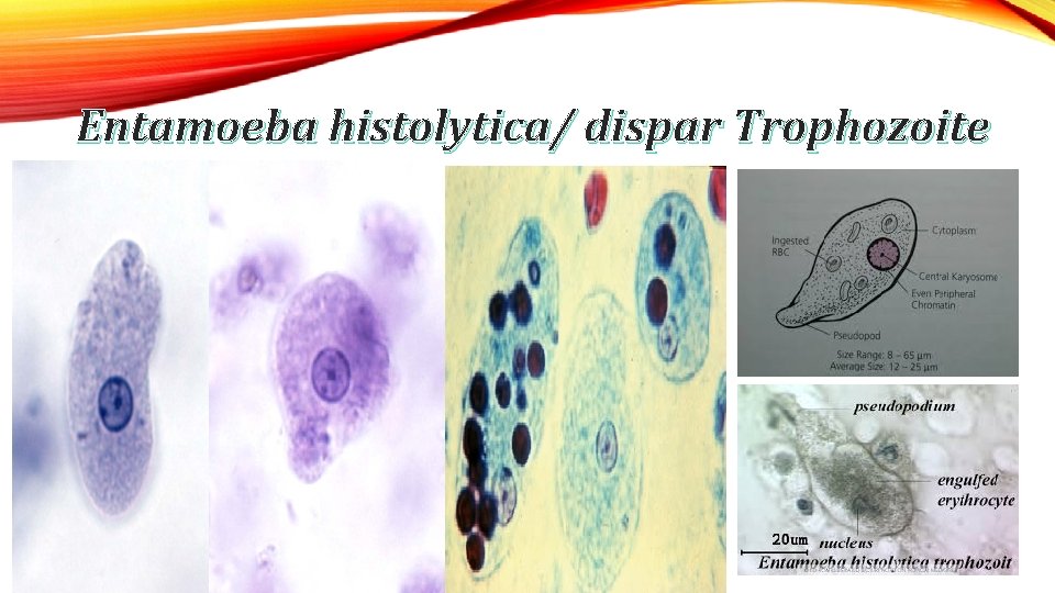 Entamoeba histolytica/ dispar Trophozoite 