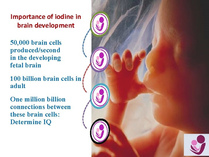 Importance of iodine in brain development 50, 000 brain cells produced/second in the developing