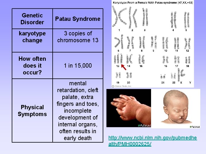 Genetic Disorder Patau Syndrome karyotype change 3 copies of chromosome 13 How often does