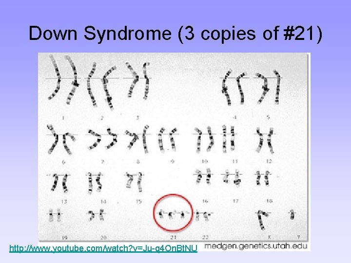 Down Syndrome (3 copies of #21) http: //www. youtube. com/watch? v=Ju-q 4 On. Bt.