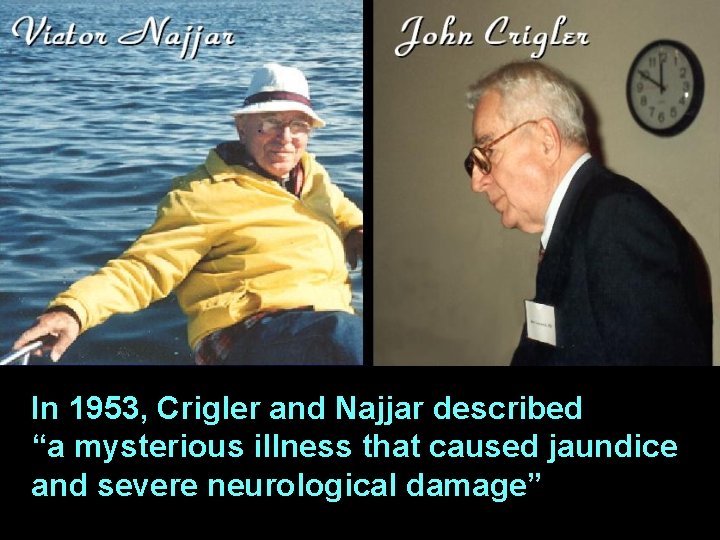 In 1953, Crigler and Najjar described “a mysterious illness that caused jaundice and severe