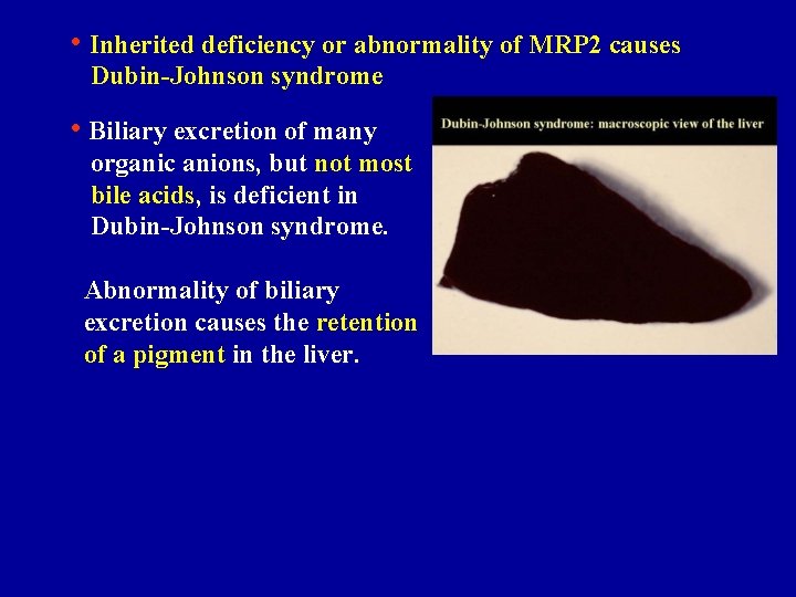  • Inherited deficiency or abnormality of MRP 2 causes Dubin-Johnson syndrome • Biliary