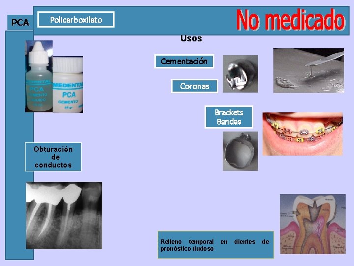 PCA Policarboxilato Usos Cementación Coronas Brackets Bandas Obturación de conductos Relleno temporal pronóstico dudoso