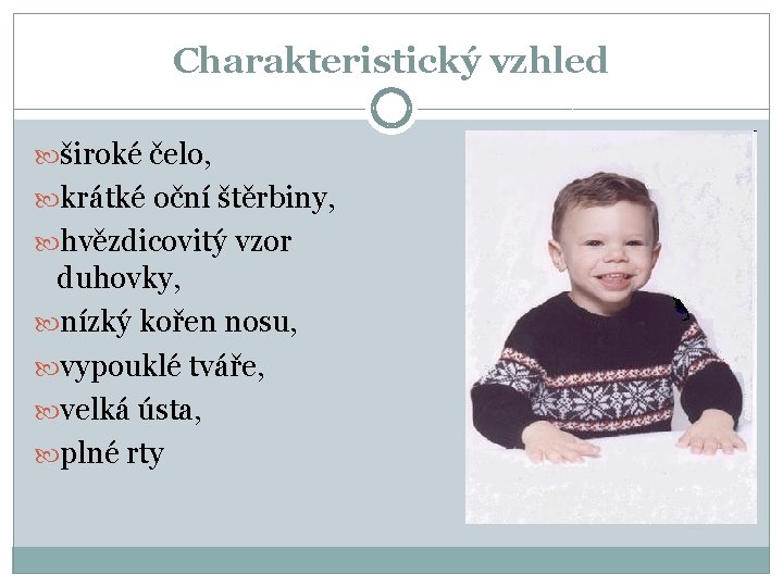 Charakteristický vzhled široké čelo, krátké oční štěrbiny, hvězdicovitý vzor duhovky, nízký kořen nosu, vypouklé
