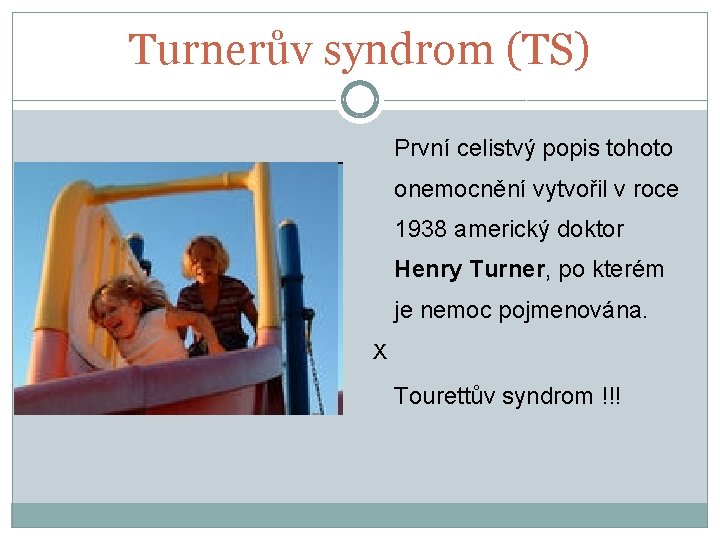 Turnerův syndrom (TS) První celistvý popis tohoto onemocnění vytvořil v roce 1938 americký doktor